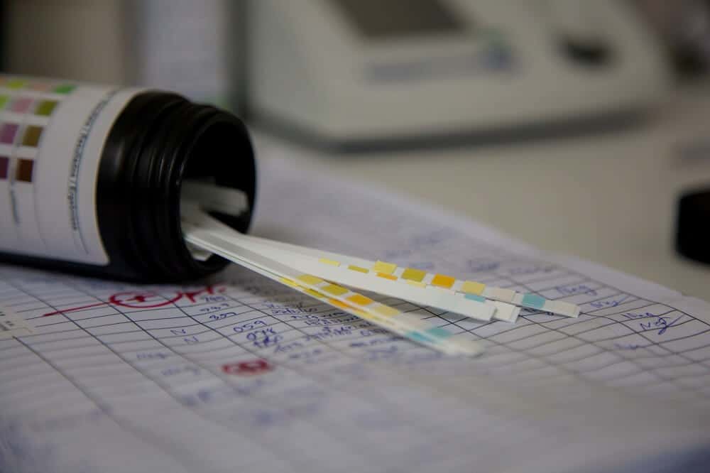 Test de dépistage pour usage de drogue